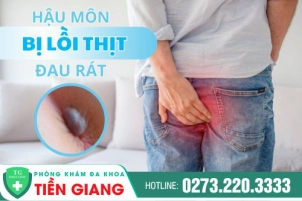 Hậu Môn Bị Lồi Thịt Đau Rát Là Bệnh Gì? Nguyên Nhân Và Cách Điều Trị