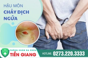 Hậu Môn Chảy Dịch Ngứa Là Dấu Hiệu Của Bệnh Gì? Cách Chữa Hiệu Quả