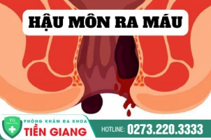 Nguyên nhân hậu môn ra máu? Cách điều trị hiệu quả hiện nay