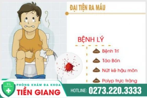 Cảnh báo dấu hiệu nguy hiểm ỉa ra máu - Xem ngay cách điều trị hiệu quả