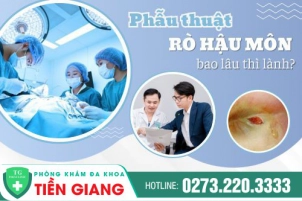 Mổ Rò Hậu Môn Bao Lâu Thì Lành?