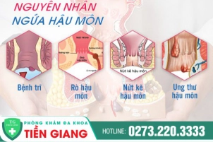 Ngứa Hậu Môn Là Do Đâu Và Cách Điều Trị Hiệu Quả