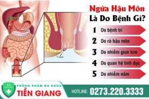 Ngứa Hậu Môn Là Biểu Hiện Của Bệnh Gì? Hướng Điều Trị Bệnh Đạt Hiệu Quả Cao