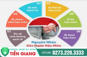 Triệu chứng ngứa hậu môn là bệnh gì?