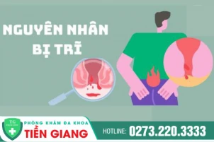 Nguyên nhân bị trĩ là gì? Điều trị bệnh trĩ ở đâu uy tín, hiệu quả?