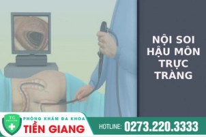 Tìm Hiểu Về Quy Trình Và Phương Pháp Nội Soi Hậu Môn Hiện Nay