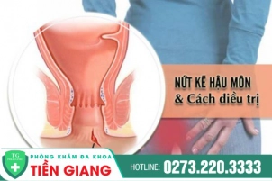 Điều Trị Nứt Kẽ Hậu Môn Như Thế Nào Là Hiệu Quả Cao?