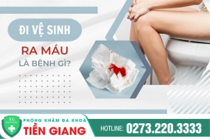 Người Bệnh Cần Lưu Ý Gì Khi Có Dấu Hiệu Đi Vệ Sinh Ra Máu