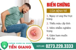 Tìm hiểu địa điểm điều trị bệnh trĩ hiệu quả uy tín tại Tiền Giang