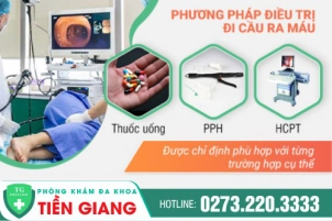 Mách Bạn Phương Pháp Trị Ỉa Ra Máu An Toàn, Chi Phí Hợp Lý