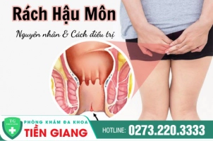 Tổng Quan Những Điều Cần Biết Về Rách Hậu Môn