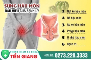 Giải Pháp Trị Sưng Hậu Môn Hiệu Quả, An Toàn Hiện Nay