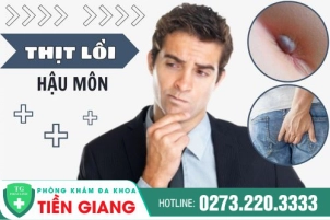 Hậu Môn Bị Lồi Là Biểu Hiện Của Bệnh Gì? Giải Pháp Điều Trị Của Giới Chuyên Gia