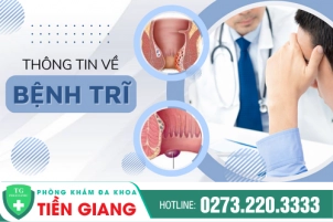 Bệnh Trĩ Và Những Thông Tin Liên Quan Bạn Cần Nắm