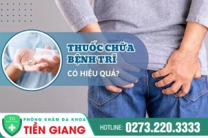 Có Nên Uống Thuốc Để Chữa Bệnh Trĩ Không? Giai Đoạn Nào Có Thể Sử Dụng Thuốc Trị Trĩ