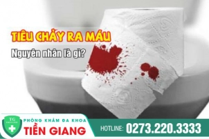 Tiêu Chảy Ra Máu Là Bệnh Gì? Nguyên Nhân Và Cách Chữa Trị Hiệu Quả