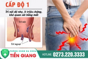Trĩ Cấp Độ 1 Thường Có Biểu Hiện Gì? Xem Ngay Nguyên Nhân Và Cách Điều Trị
