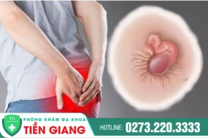 Hình ảnh bệnh lòi dom từ nhẹ đến nặng - Nhìn để biết, biết để chữa kịp thời