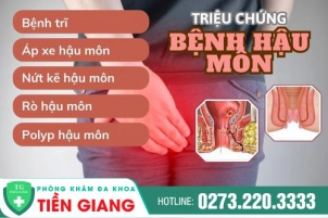 Dấu Hiệu Của Bệnh Hậu Môn Là Gì, Cùng Tìm Hiểu Với Bác Sĩ Chuyên Khoa Nhé