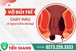 Vỡ Búi Trĩ Phải Làm Sao? Vỡ Búi Trĩ Chảy Máu Có Nguy Hiểm Không?