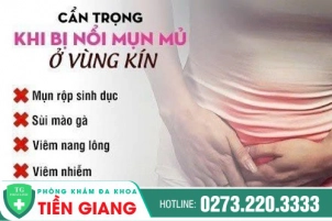 Nổi mụn mủ ở vùng kín có nguy hiểm không? Cách điều trị bệnh nhanh chóng