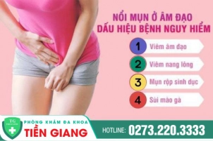 Nổi Mụn Âm Đạo Nguy Hiểm Như Thế Nào? Chữa Bằng Cách Nào Hiệu Quả?