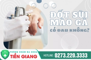 Đốt Sùi Mào Gà Có Đau Không? Bao Lâu Thì Khỏi?
