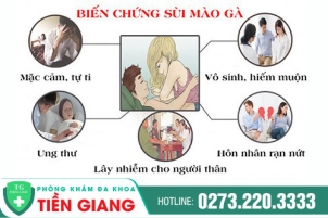 Phòng khám sùi mào gà Tiền Giang - Trị sùi mào gà bằng cách nào hiệu quả?