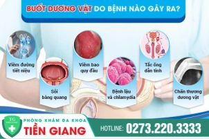 Cẩn trọng buốt dương vật dấu hiệu một số bệnh nguy hiểm