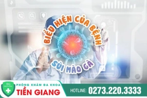 Biểu Hiện Thường Gặp Ở Sùi Mào Gà Người Bệnh Không Nên Xem Thường