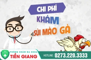 Chi Phí Điều Trị Bệnh Sùi Mào Gà Khoảng Bao Nhiêu? Quy Trình Ra Sao?