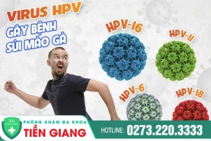 Sùi mào gà ở dương vật: Nguyên nhân và cách điều trị hiệu quả