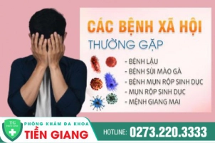 Bệnh Xã Hội Có Chữa Được Không Và Chữa Như Thế Nào Để Hiệu Quả?