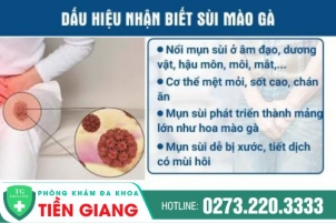 Tổng Quan Về Sùi Mào Gà - Nhận Biết Các Bệnh Giống Sùi Mào Gà