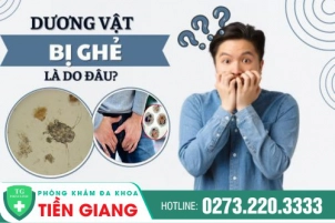 Các Tác Nhân Khiến Nam Giới Bị Ghẻ Bộ Phận Sinh Dục