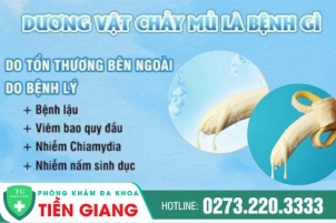 Lo Lắng Vì Dương Vật Chảy Mủ - Nam Giới Cần Xử Lý Ra Sao?