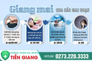 Những Triệu Chứng Cảnh Báo Bệnh Giang Mai Qua Từng Giai Đoạn