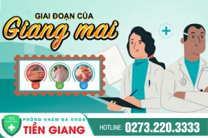 Những Giai Đoạn Phát Triển Của Bệnh Giang Mai Mà Bạn Cần Biết