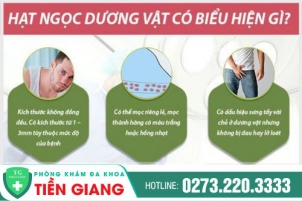 Tổng Quan Về Chuỗi Hạt Ngọc Dương Vật Ở Nam Giới