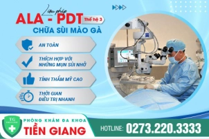 Tìm hiểu bệnh sùi mào gà ở hậu môn, tác hại và cách điều trị hiện nay