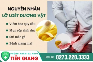 Nguyên Nhân Chủ Yếu Khiến Dương Vật Bị Lở Loét