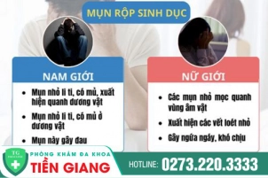 Phòng khám mụn rộp sinh dục Tiền Giang - Điều trị mụn rộp sinh dục ở đâu an toàn?