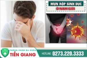 Những Dấu Hiệu Giúp Phái Nam Nhận Biết Sớm Mụn Rộp Sinh Dục