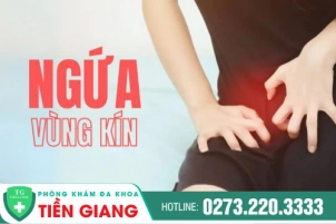 Nổi mẩn ngứa ở vùng kín là do đâu? Phương pháp điều trị bệnh hiệu quả