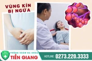 Phương Pháp Điều Trị Ngứa Vùng Kín Nhanh Chóng, Hiệu Quả Và An Toàn