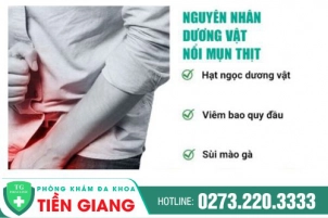 Nổi Mụn Thịt Ở Dương Vật Có Nguy Hiểm Không? Điều Trị Bằng Phương Pháp Gì?