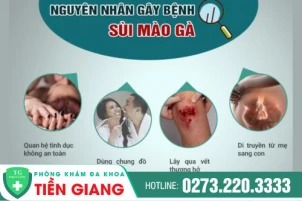 Tìm hiểu các phương pháp điều trị sùi mào gà hiệu quả hiện nay