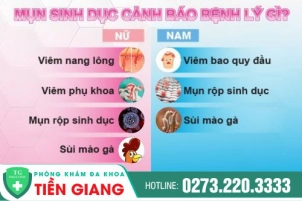 Bác sĩ da liễu giỏi hướng dẫn cách chữa mụn sinh dục ở nam và nữ hiệu quả