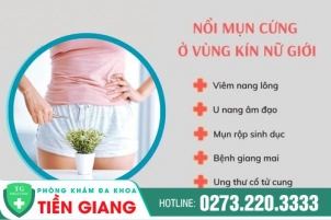 Nổi Mụn Ở Vùng Lông Mu Nữ Giới Nguy Hiểm Như Thế Nào?