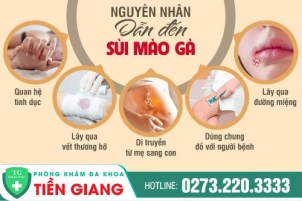 Những Nguyên Nhân Gây Bệnh Sùi Mào Gà Mà Người Bệnh Không Ngờ Tới